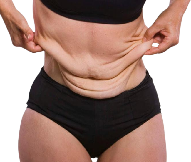 Body contouring and fat reduction surgical outcome