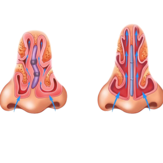 Nasal and respiratory reconstruction clinical image