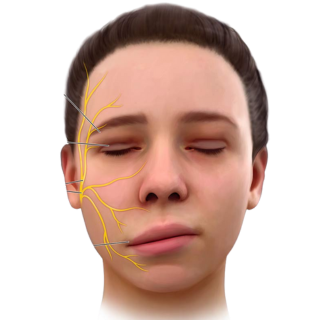 Neurological and pain relief surgeries overview