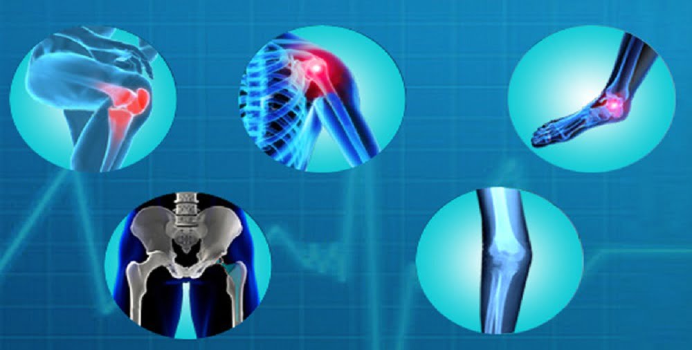 Soft Tissue and Functional arthritis Reconstruction