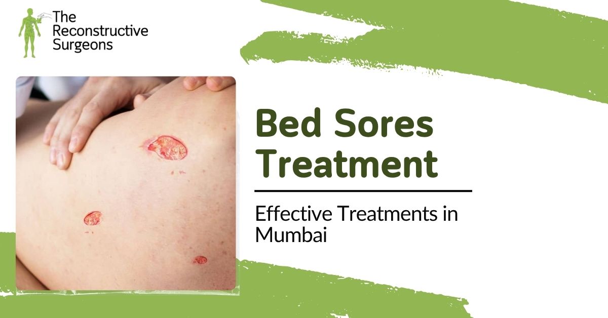 Bed Sores & Pressure Sore Treatments Blog Image