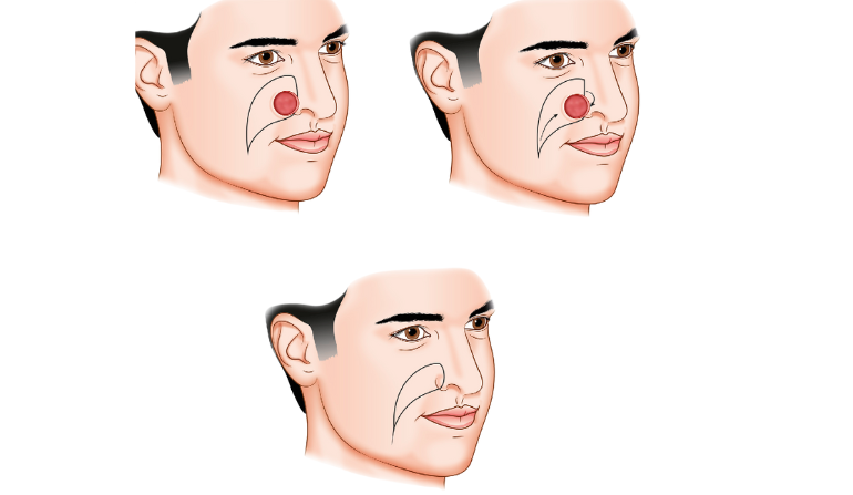 Facial Trauma Repair
