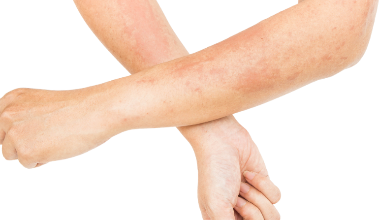 Infection-Related Damage Repair