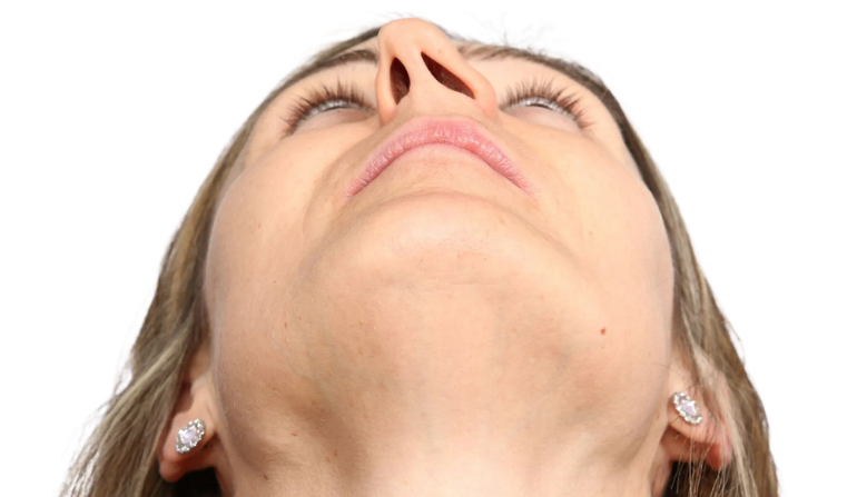 Nasal and Respiratory Surgeries