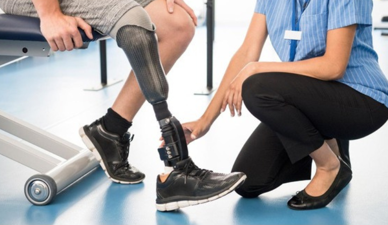 Prosthetics Integration